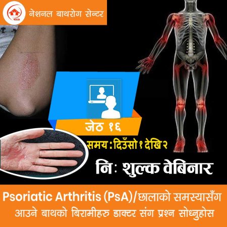 Psoriatic Arthritis (PsA) Webinar